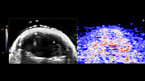 B-mode of mouse brain next to PA oxyhemo image of mouse brain