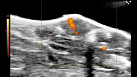 Power Doppler image of mouse tumor