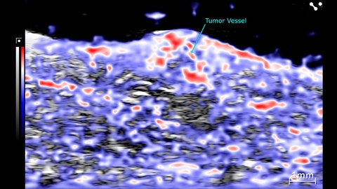 PA oxyhemo scan of tumor region in mouse