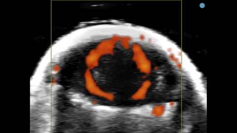 Power Doppler image of mouse brain