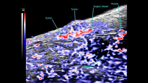 OxyHemo sO2 maps of the tumor and surrounding tissue of a subcutaneous prostate tumor in mouse