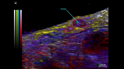 Unmixing from a Spectro scan of a subcutaneous prostate tumor region