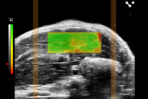 Shear wave elastography with two bars on both sides, allowing for a wider box to image stiffness in a healthy mouse liver.