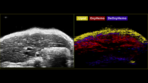 Multiwavelength PA imaging view of the liver