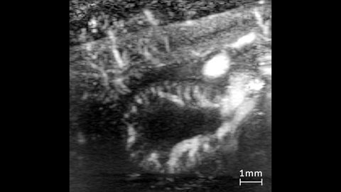 Ultrafast Doppler Image of a Mouse Kidney acquired using VADA.