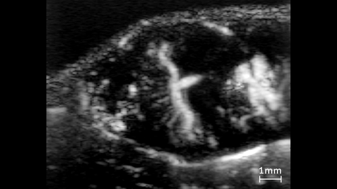 Ultrafast Doppler Image of a Mouse Placenta acquired using VADA.