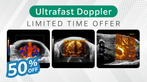 Ultrafast Doppler: Limited Time Offer