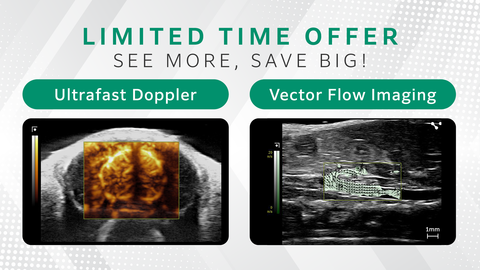 Limited time offer: Ultrafast Doppler and Vector Flow Imaging