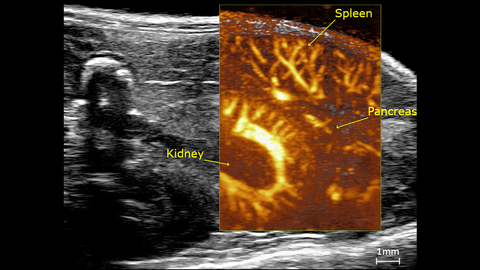Ultrafast Doppler image of a mouse kidney showing the vasculature of the spleen and pancreas.