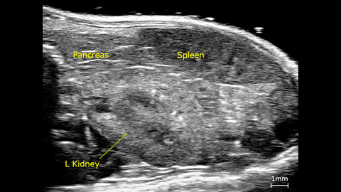 Ultrafast Doppler image of a mouse kidney, spleen and pancreas.