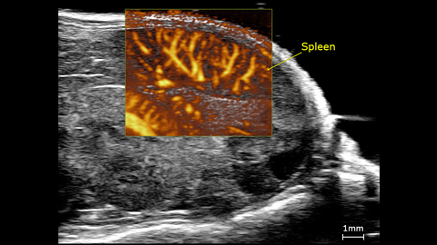 Ultrafast Doppler image of a mouse spleen showing the vasculature.