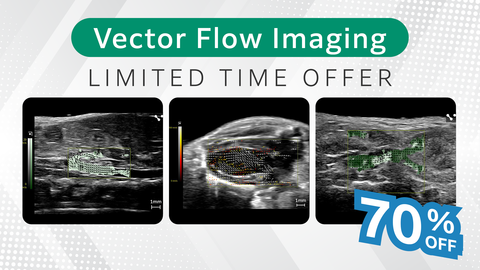 Vector Flow Imaging: Limited Time Off 70% Off
