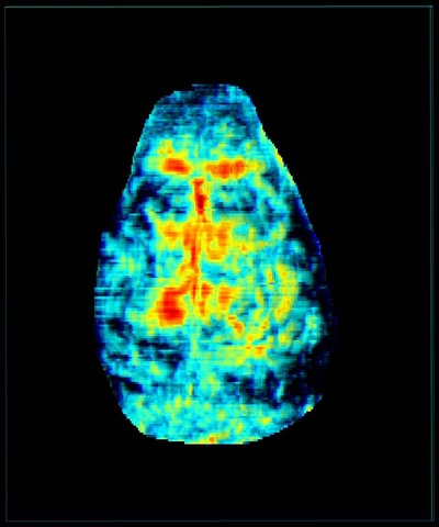 Brain-skin-off-680nm-color.jpg