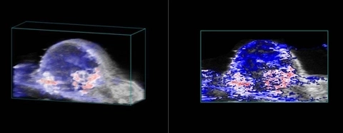 Tumor-oxyhemo-render-and-2D.jpg