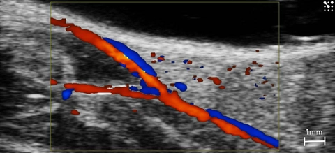 femoral-bifurcation-mouse-color.jpg