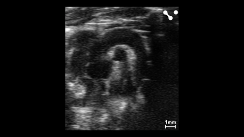 Aortic arch in a mouse.jpg