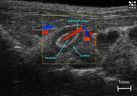 Color Doppler mouse adrenal.jpg