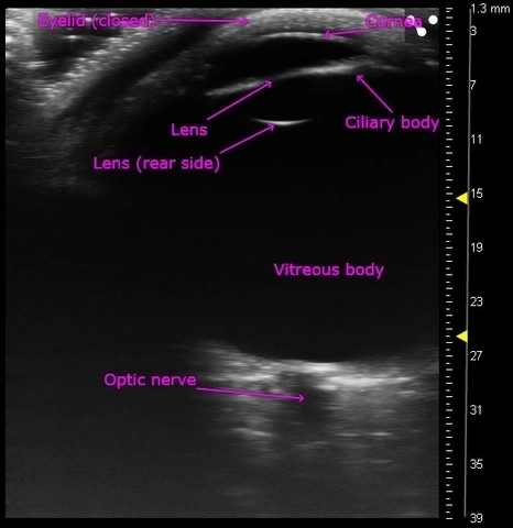 Vevo MD Clinical High-Frequency Ultrasound