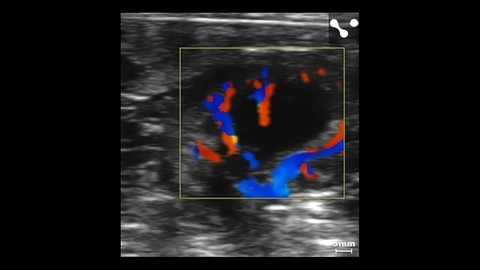 Kidney color Doppler in small dog.jpg