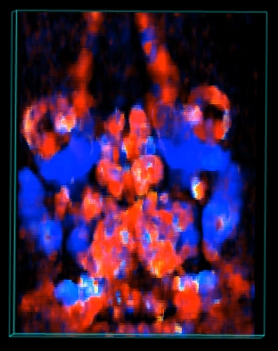 Mouse-brain-color-dopp-ren.jpg