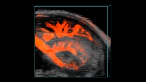 Murine renal vasculature in 3D.jpg