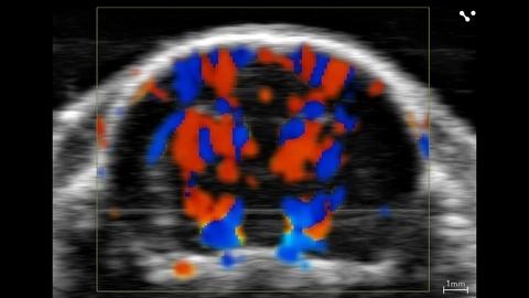 Rat brain color_uhf22x skull _ scalp.jpg