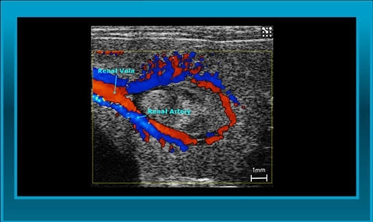 abdominal imaging