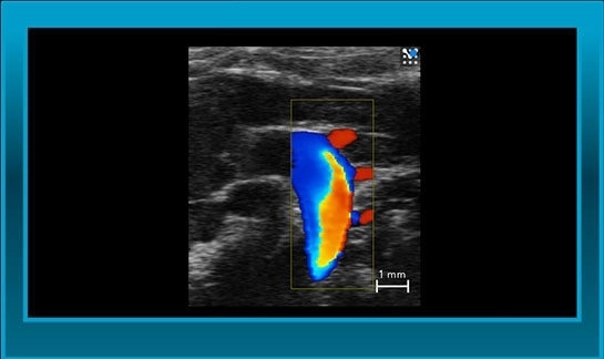 cardiovascular imaging