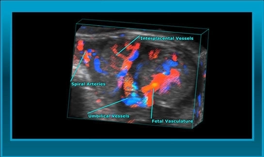 developmental imaging