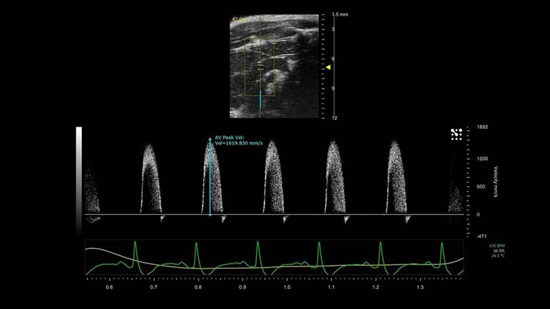 PW Doppler of the Pulmonary Artery in a Mouse