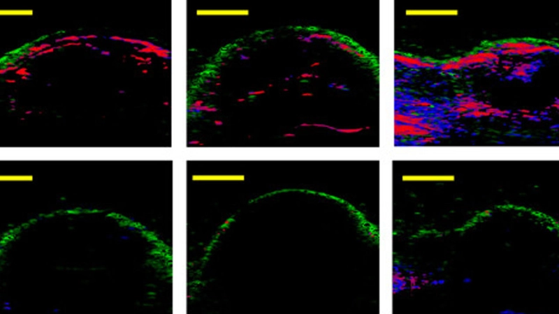 Validation of blood oxygenation and melanin signal from photoacoustic imaging