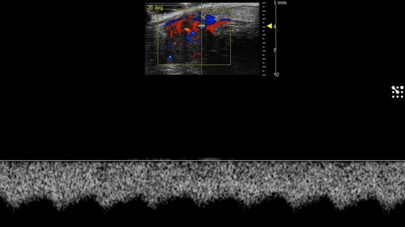 Mouse Testicular Artery Blood Flow