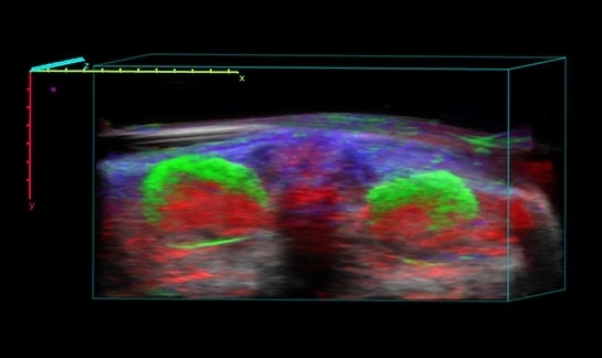 Molecular Biology - Targeted agent accumulation in the kidney.jpeg