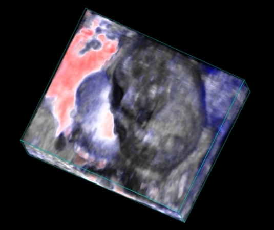 Embryo oxyhemo-3D-100%-O2.jpg