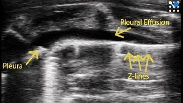 Rat pleural effusion and thickening.jpg