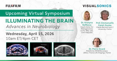 Illuminating the Brain: Advances in Neurobiology post featuring three different views of the mouse brain