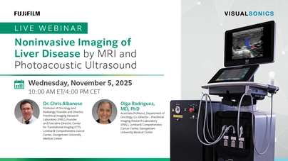 Noninvasive Imaging of Liver Disease by MRI and Photoacoustic Ultrasound