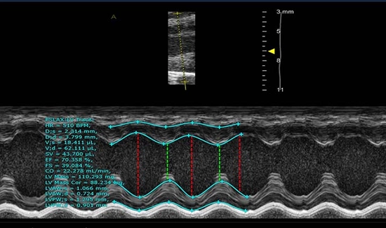 Anatomical M-Mode PSLAX