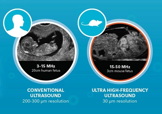 Conventional vs. Ultra-high Frequency Ultrasound Conventional vs. Ultra-high Frequency Ultrasound