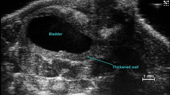 Mouse bladder with thickened walls.