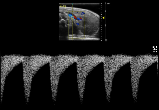 Pulsed-Wave Doppler of the renal artery in a mouse used to calculate blood flow velocities, etc. 