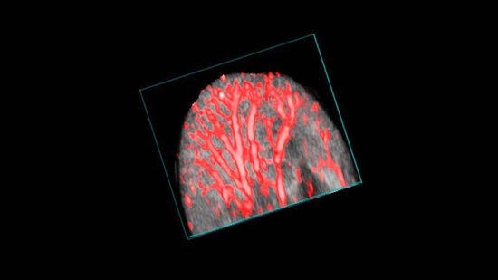 Mouse Ear Single Wavelength