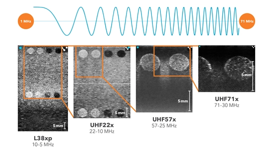 The Vevo F2 offers an expanded range of frequencies (71–1 MHz). Users now have the flexibilty to image at low frequency for penetration and ultra high frequency for resolution using one platform. Wavelength moving from left to right (1-71 MHz), phantom image scanned using L38xp, UHF22x, UHF57x and UHF71x showing the depth.