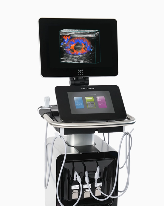 fujifilm ultrasound
