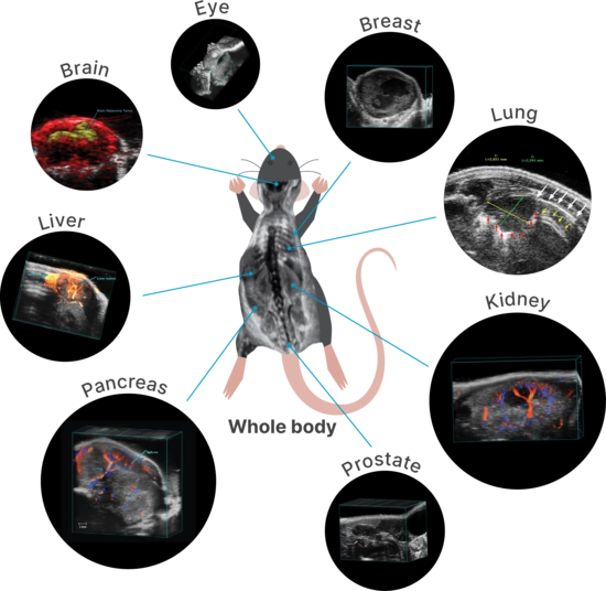 Image the whole body or get organ-specific